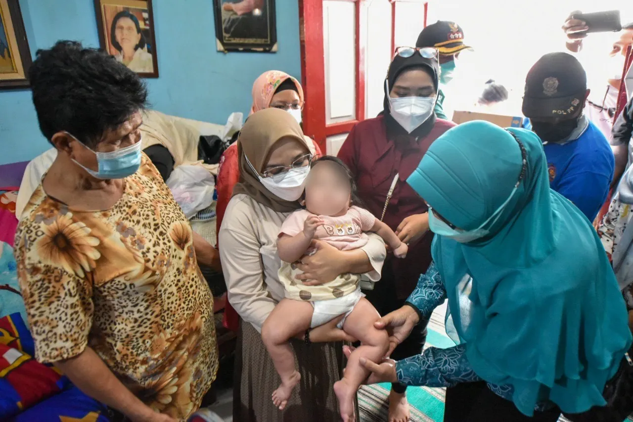 Rini Indriyani Beri Bantuan 2 Anak Penyandang Cerebral Palsy dan Hidrosefalus