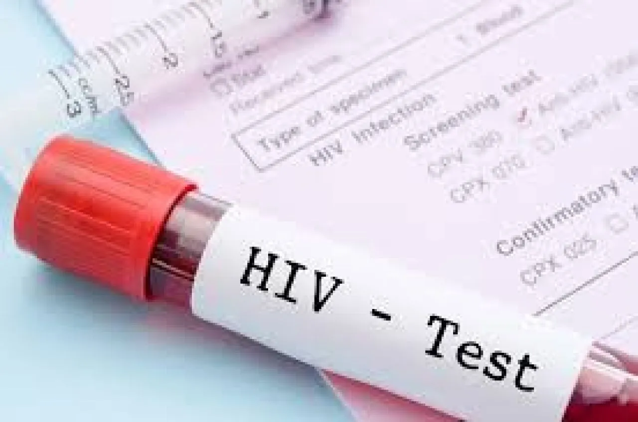 Warga Surabaya Tenang, Layanan Pengobatan HIV Tidak Terkena Efisiensi Anggaran